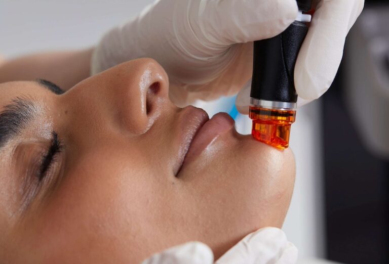 Professionelle Hydrafacial-Behandlung bei MP Cosmetic in Berlin-Hermsdorf